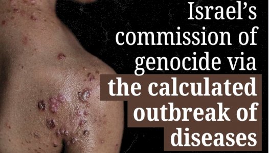 Israel&rsquo;s commission of genocide via the calculated outbreak of diseases